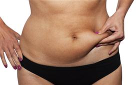 The Process Before and After the Abdominoplasty.